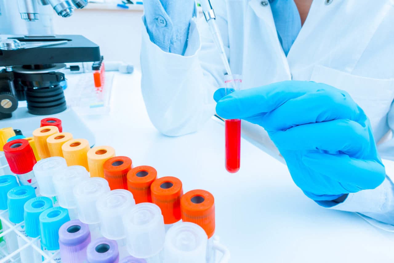 Præimplantationsgenetisk diagnose ved IVF Riga